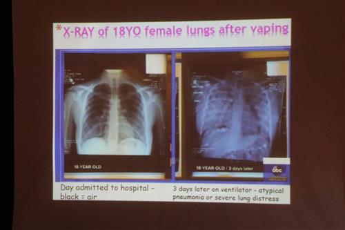 A slide from Lynn Riemer's drug presentation